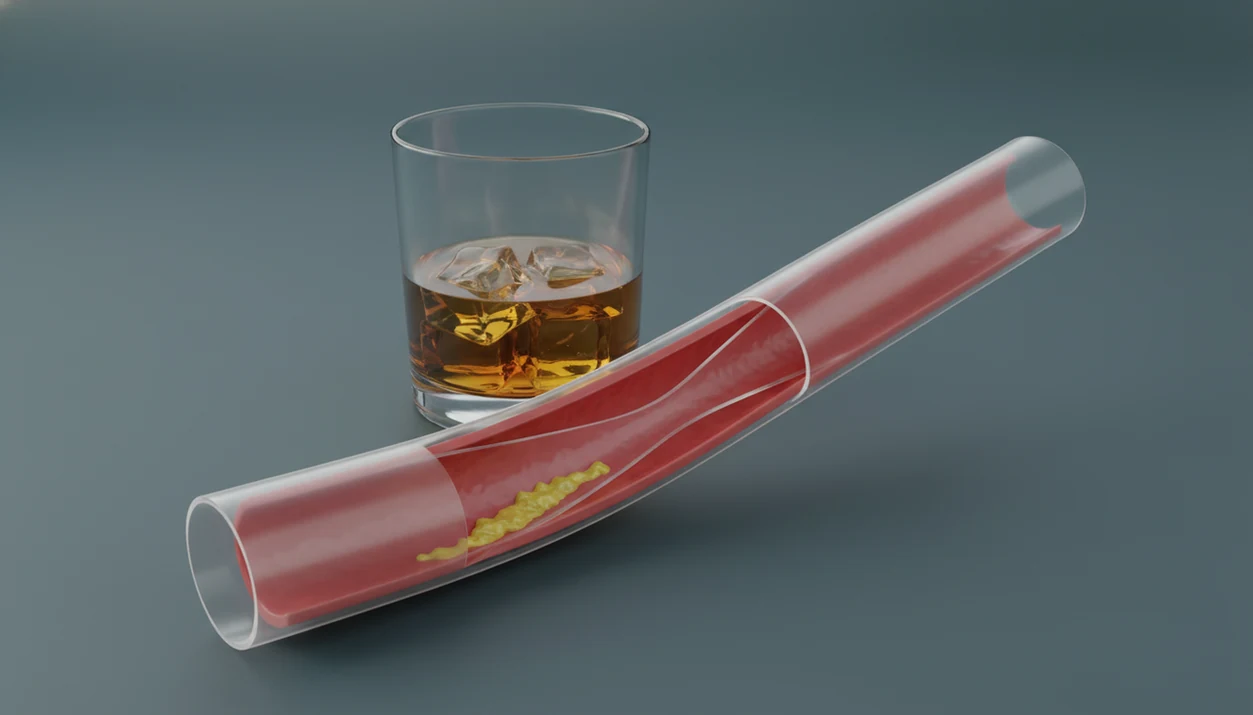 A medical-style artery cross-section with plaque appears beside a glass of alcohol.